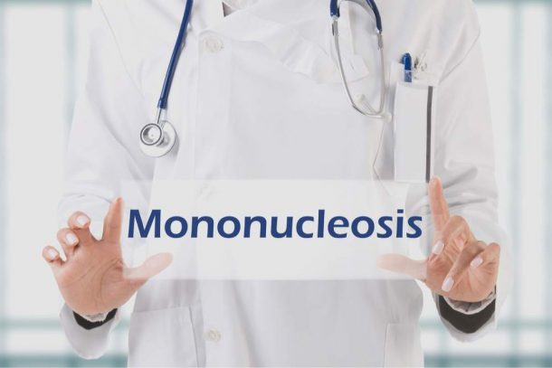 mononucleosi sintomi