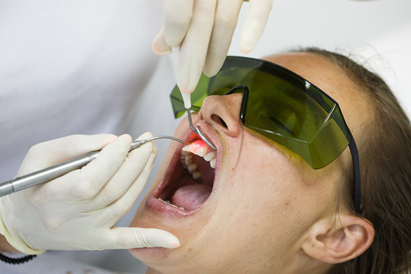 laser dentale 