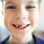 Sorriso di un bambino gioioso con denti da latte