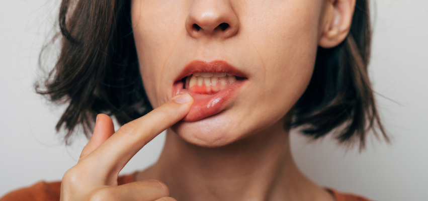 Giovane donna che soffre di parodontite si controlla le gengive