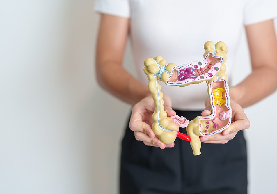 Studentessa che mostra un modello anatomico dell’intestino a grandezza naturale per rappresentare il concetto di tumore e di prevenzione della salute intestinale