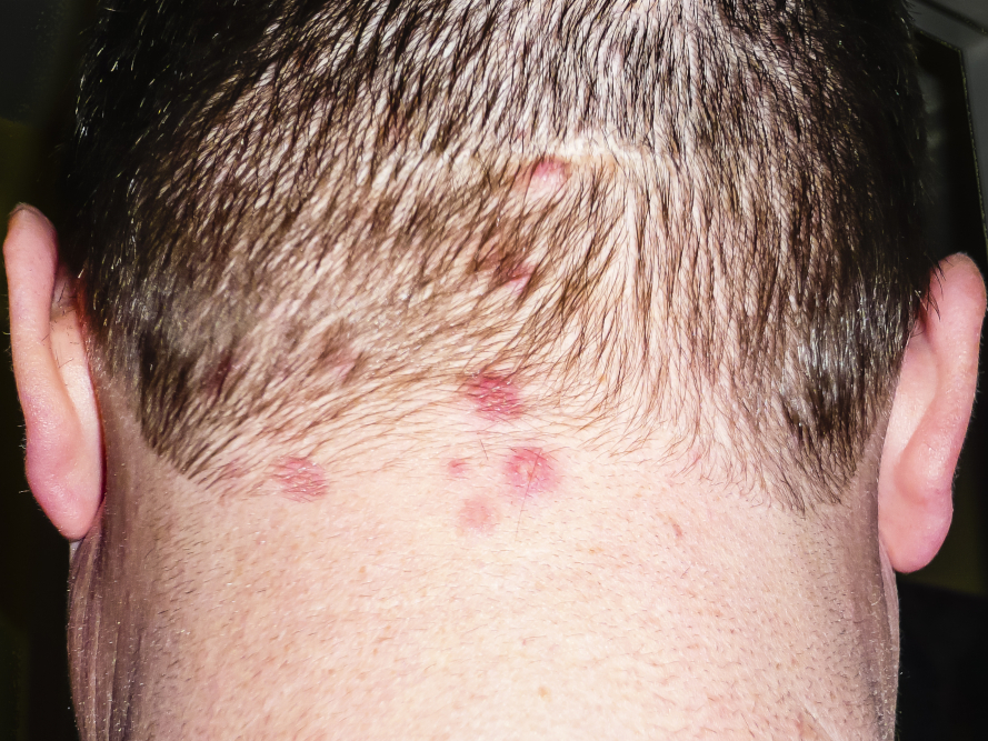 aspira solidi e liquidi senza sacco Malattie infettive a confronto: una guida fotografica per i genitori main image 1