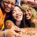 Ragazze allegre che si abbracciano convivono con una situazione di salute comune essendo in cura dalla vitiligine