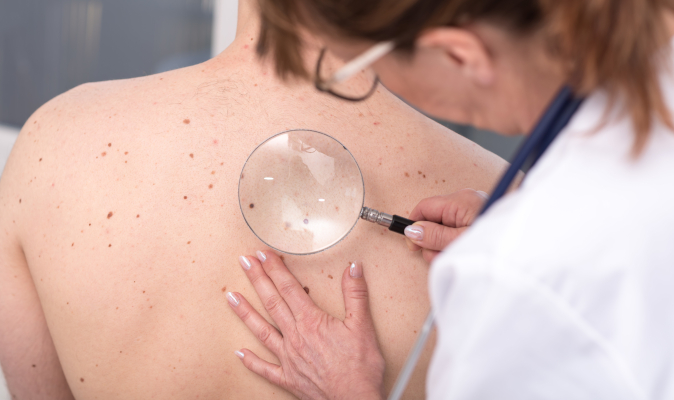 Dermatologo controlla nei del paziente per la diagnosi di un eventuale melanoma maligno