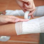 fasciatura braccio per ustione