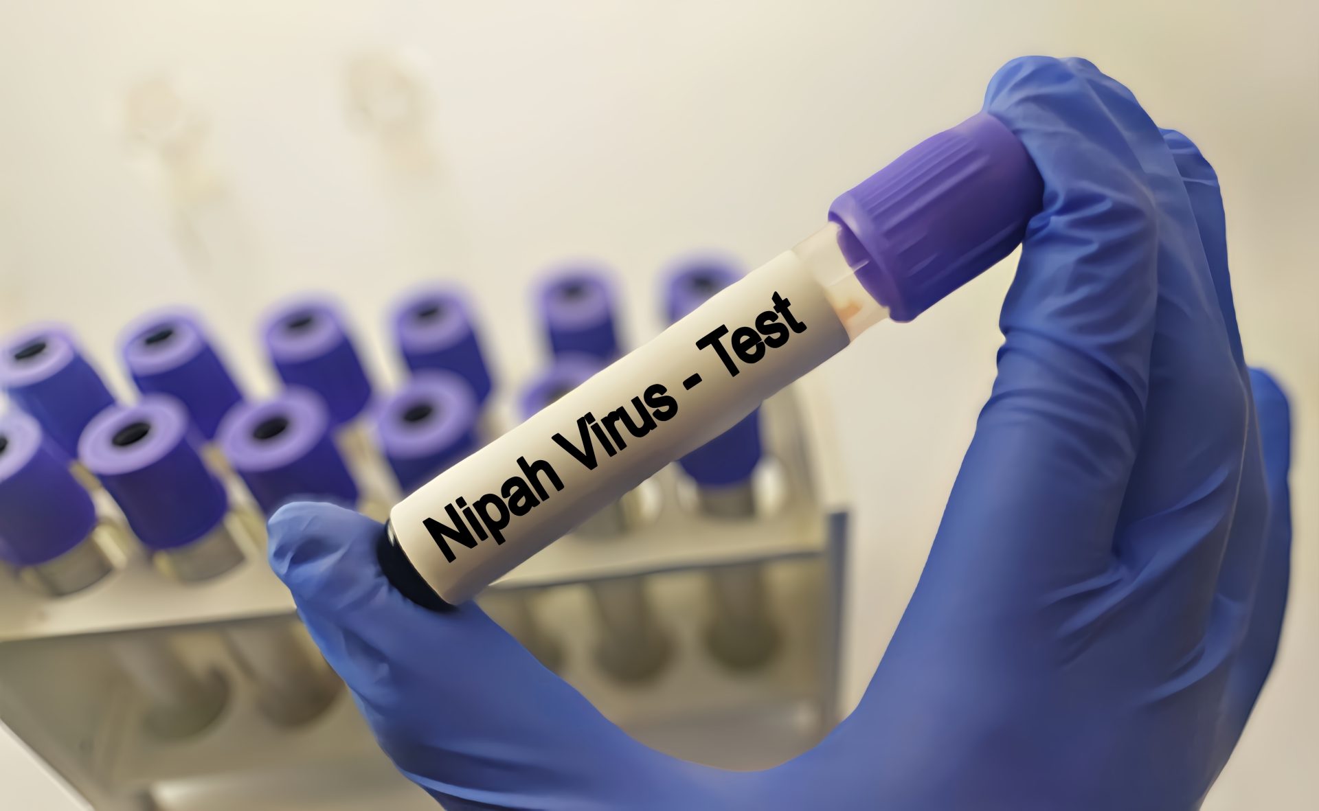 provetta nipah virus