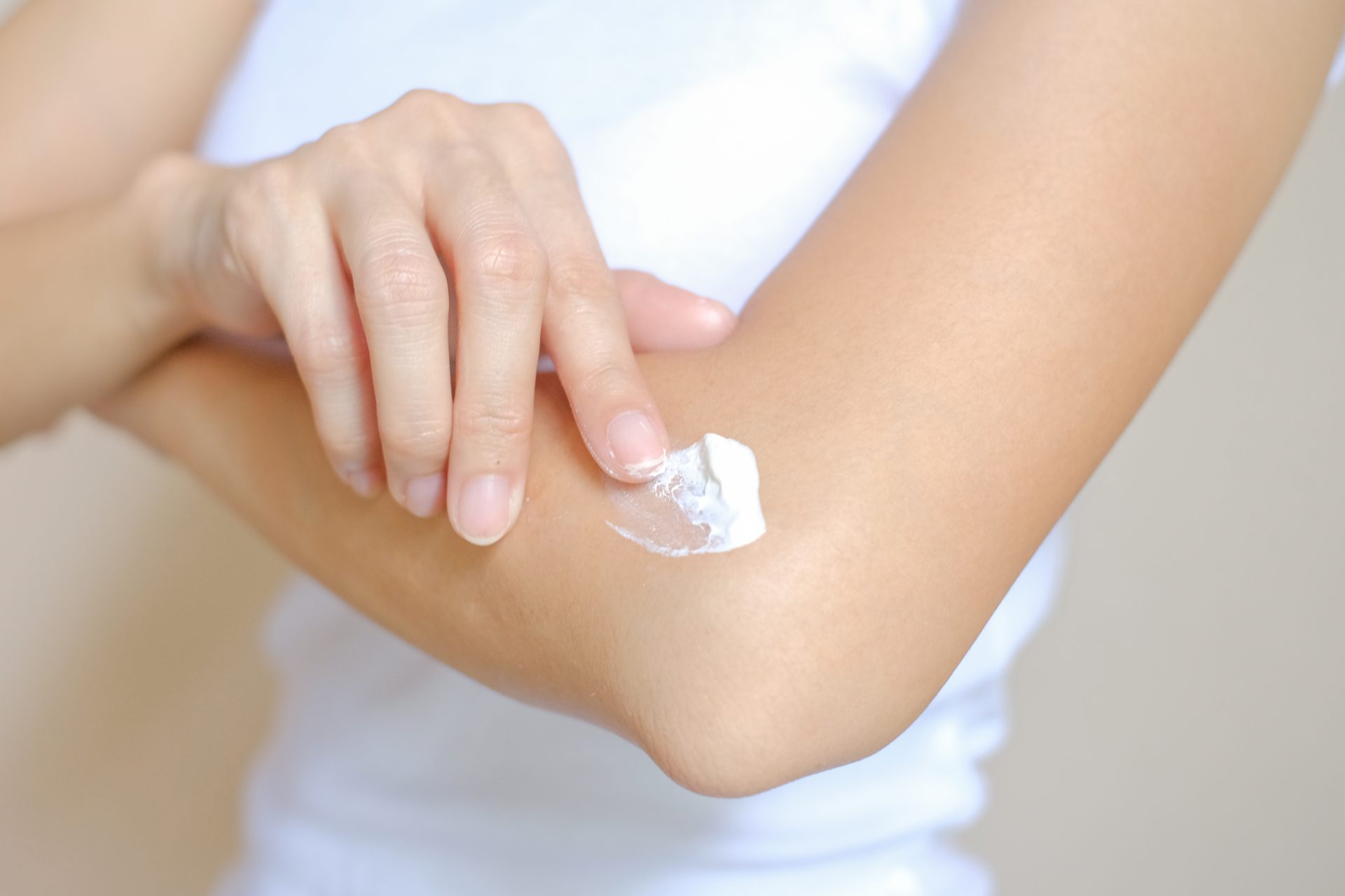 donna applica pomata su gomito