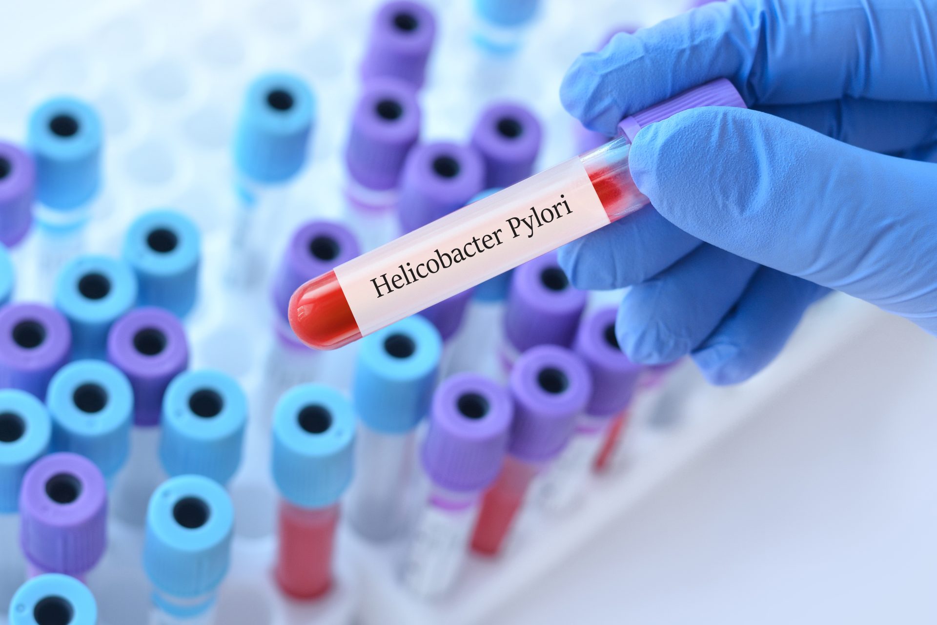 helicobacter pylori test