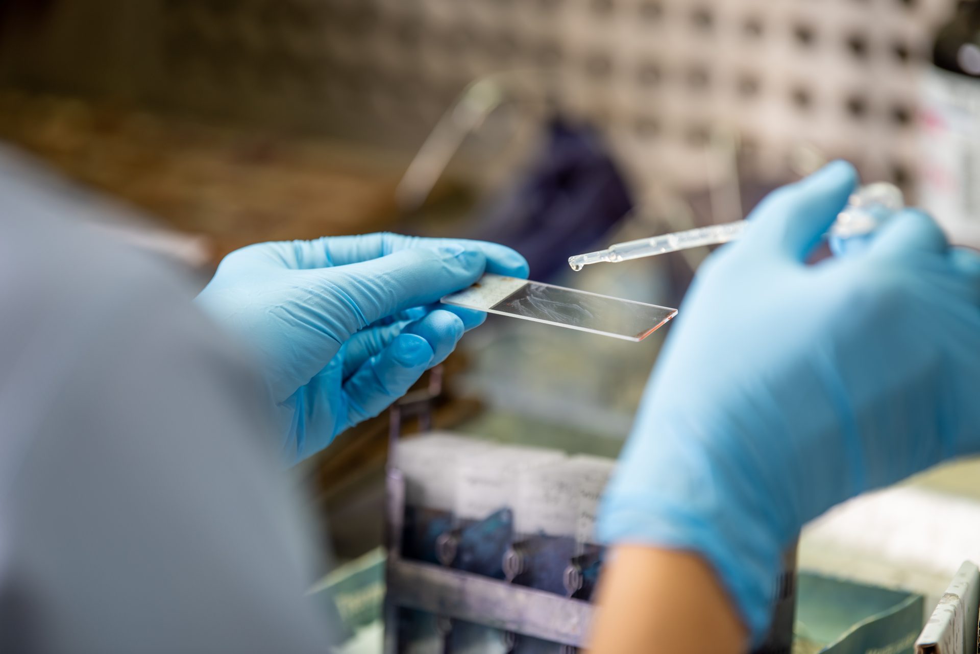 analisi citologica di un campione su vetrino