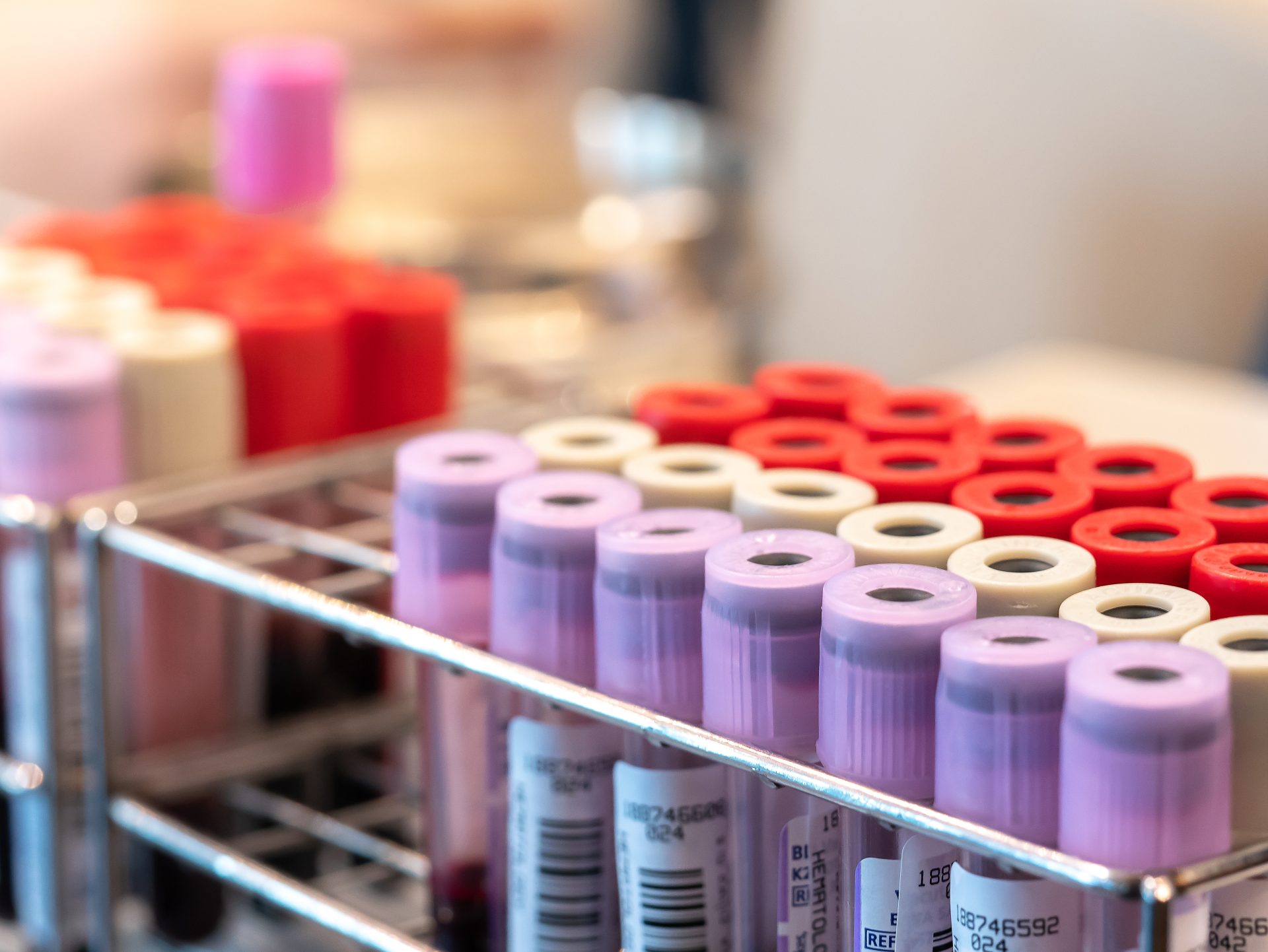 provette per analisi del sangue