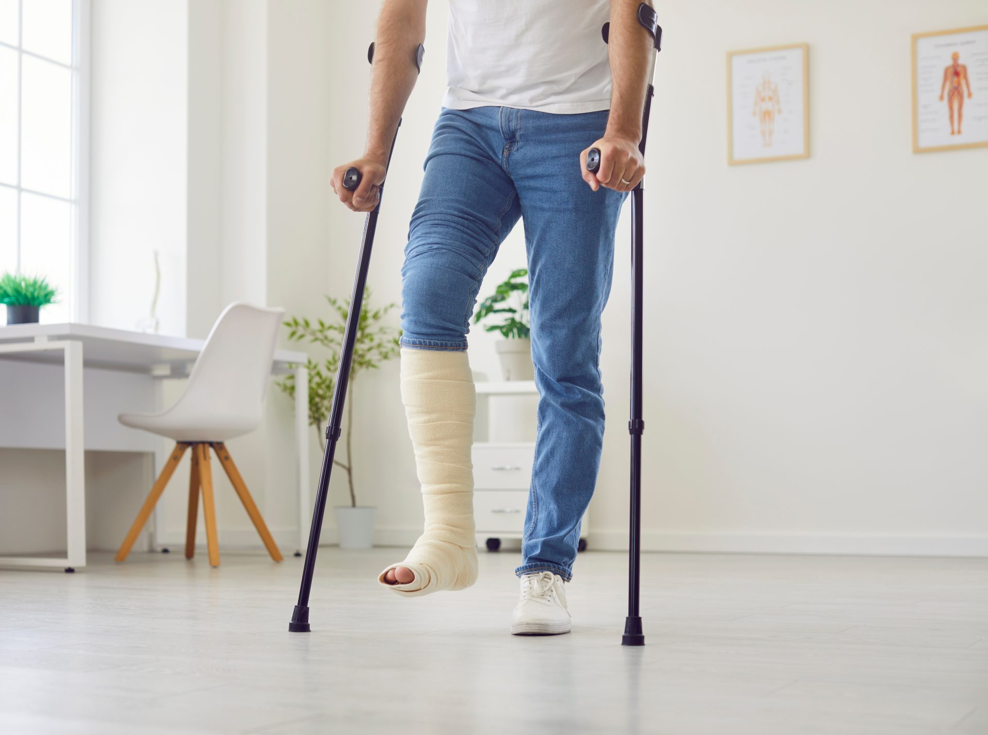 uomo con gamba ingessata e stampelle