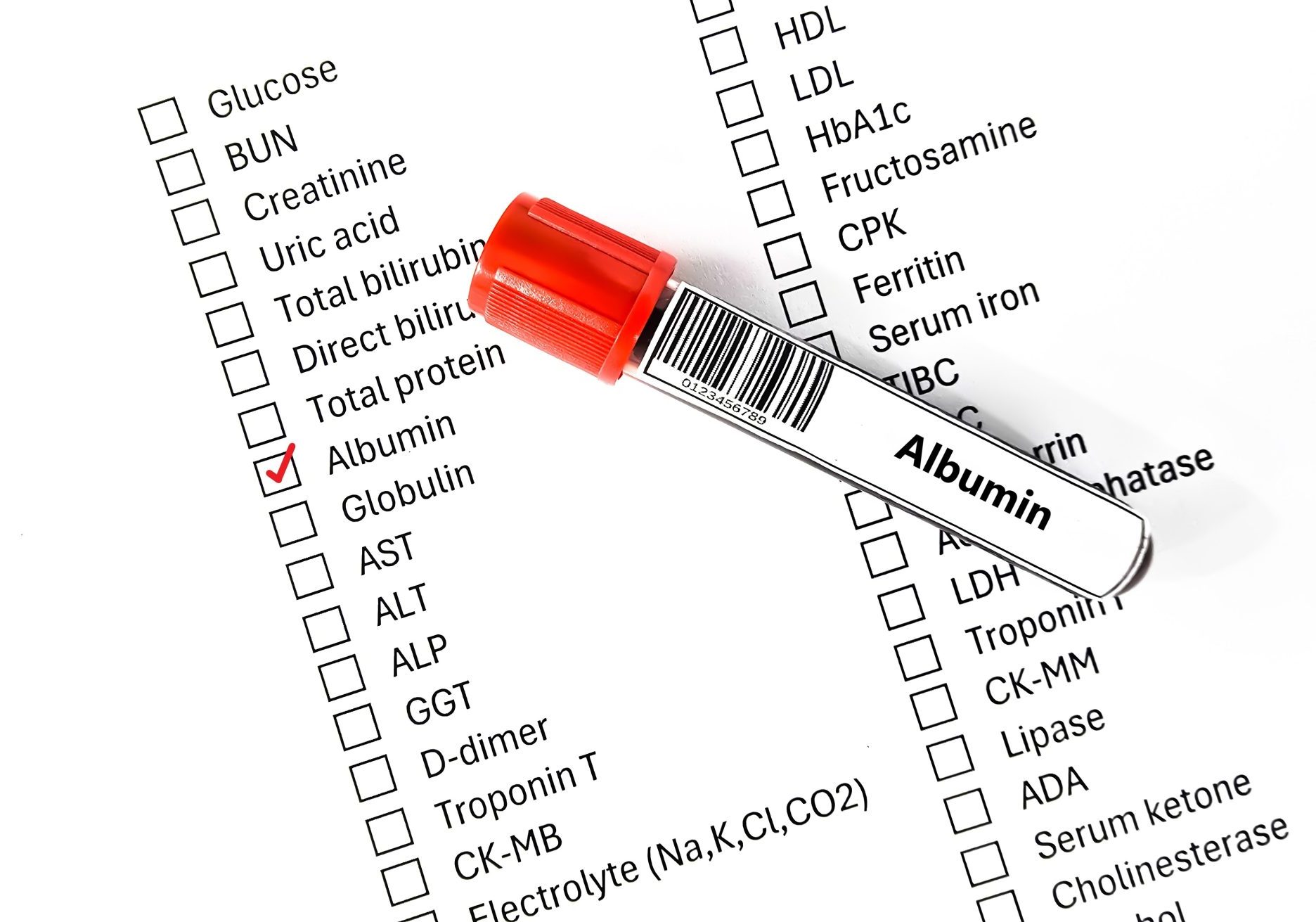 test urine albumina