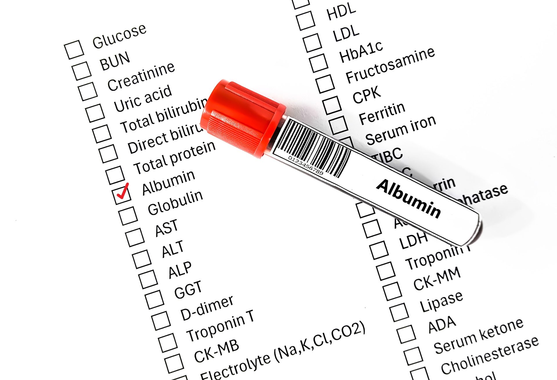 test urine albumina