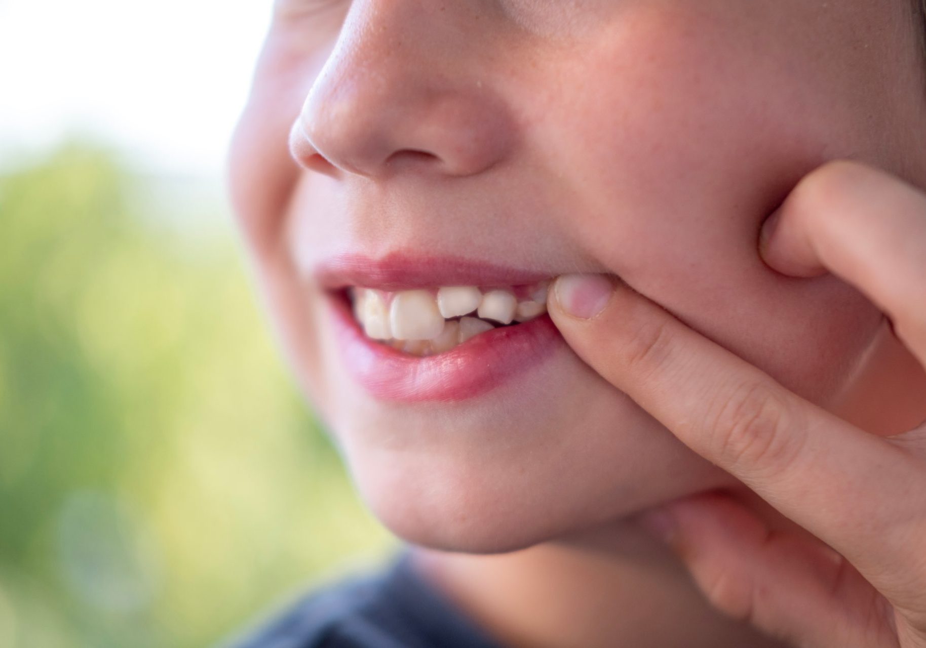 bambino con denti storti